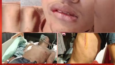 Geger..!! Akibat Pesta Miras Tiga  Pengamen Jalanan Jadi Korban Bacok 