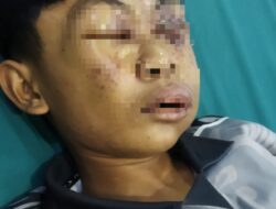 Viral Santri Lebam di Ponpes Kubu Raya, Pihak Pesantren Sebut Alergi Parasetamol